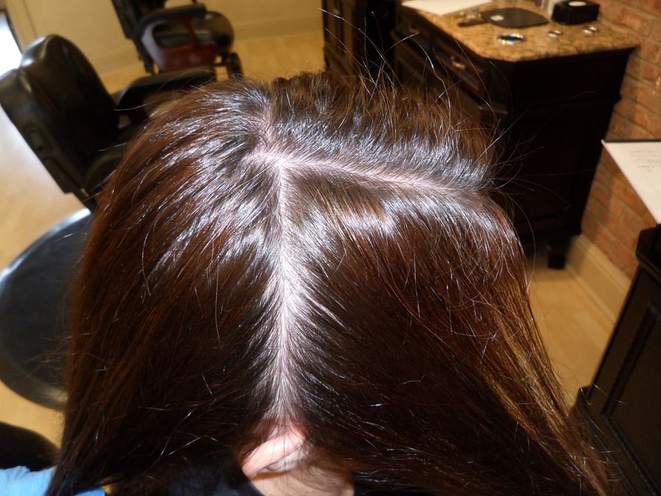 can see scalp through hair in light